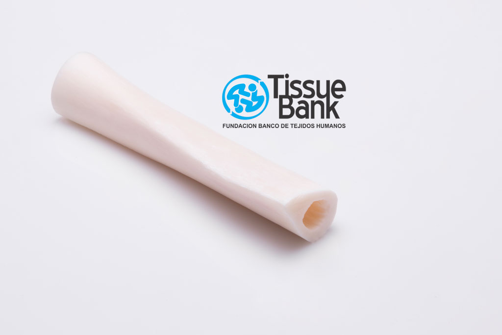 Cilindro de tibia