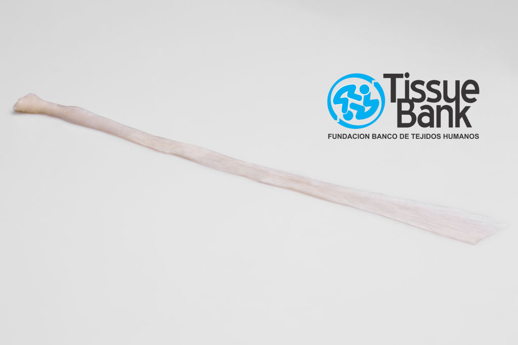 Tendón tibial